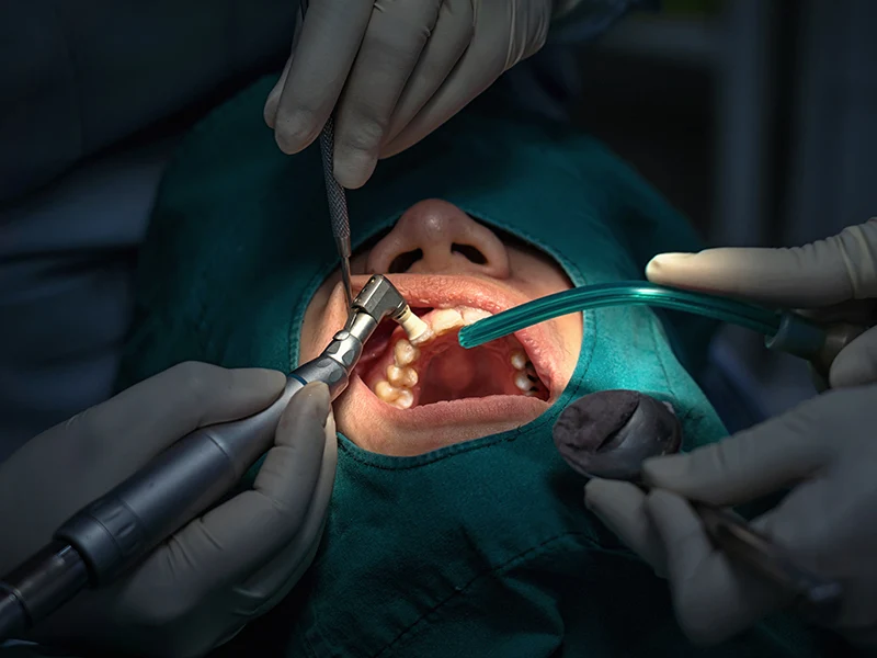 periodontal tratamiento en Ciudad Real